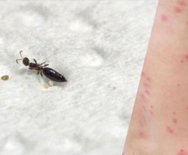 Dermatite estiva da scleroderma domesticum (Parassita del tarlo)