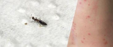 Dermatite estiva da scleroderma domesticum (Parassita del tarlo)